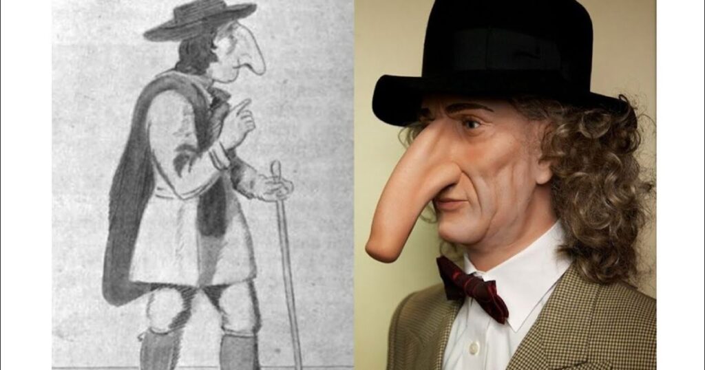 The Astonishing Story Of Thomas Wadhouse, The Man With The World's Longest Nose